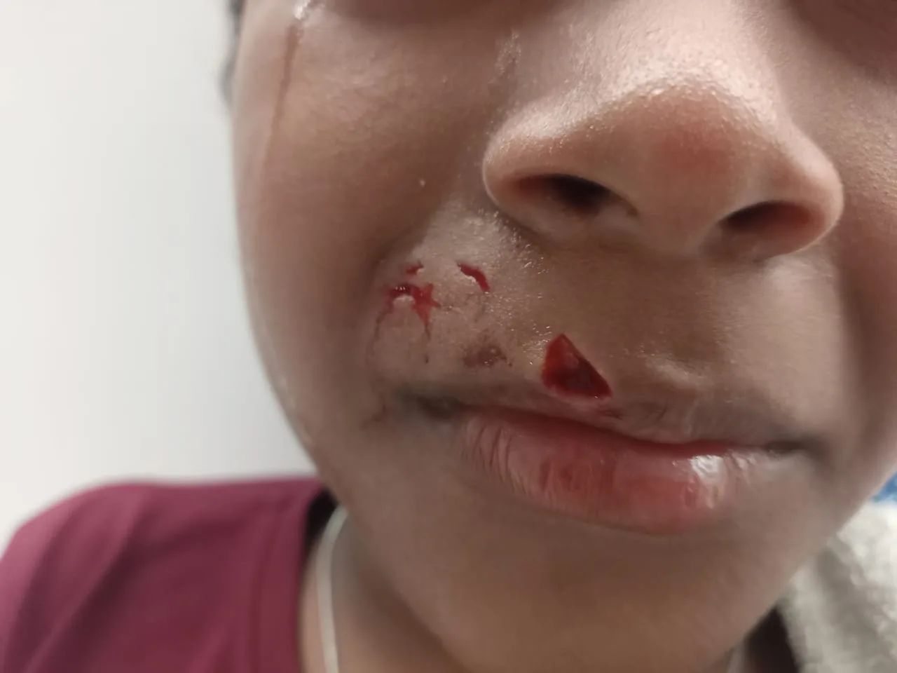 Menor fue atacado por perro sin control en el barrio Villa Castro