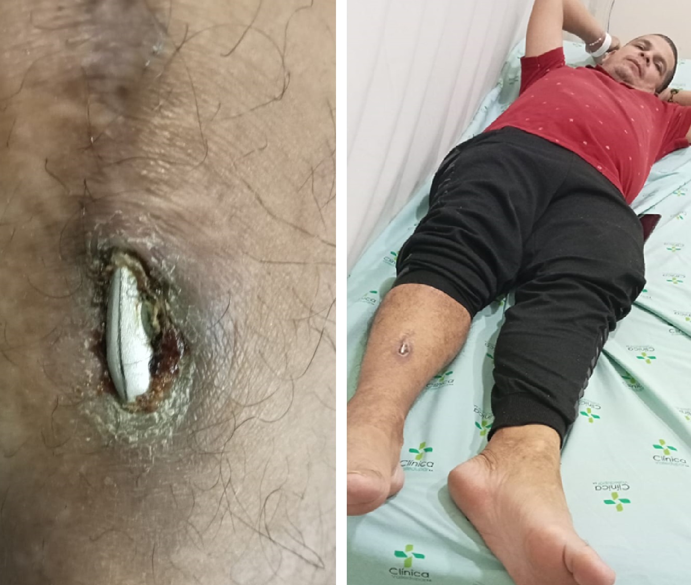 Pareja de amantes ultimada a tiros al interior de un motel en La Loma