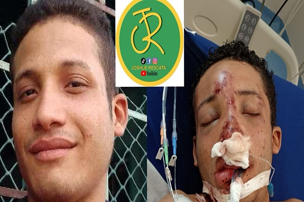 Grave estado de salud de joven herido en el Centro Histórico de Valledupar