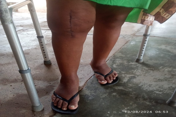 Familia denuncia falta de atención médica especializada por parte de Coosalud en Valledupar