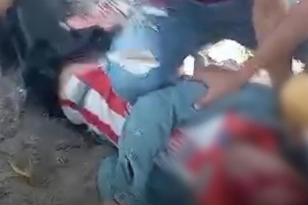 Tiroteo en El Copey deja un hombre gravemente herido