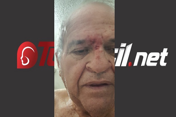 Por robarlo fue agredido en plena calle líder social de Valledupar