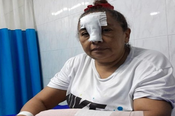 Accidentes en el parque de Don Alberto por trabajos de Nihat generan preocupación en la comunidad