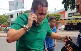 Esposo de la alcaldesa de La Jagua del Pilar fue herido en aparente intento de atraco en Valledupar