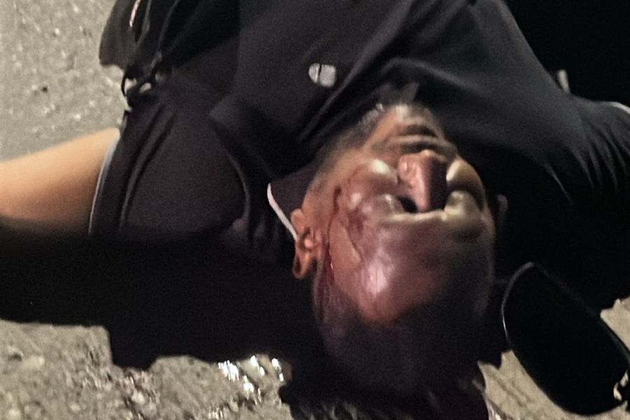 Identifican a hombre asesinado en el barrio Los Milagros al sur de Valledupar 